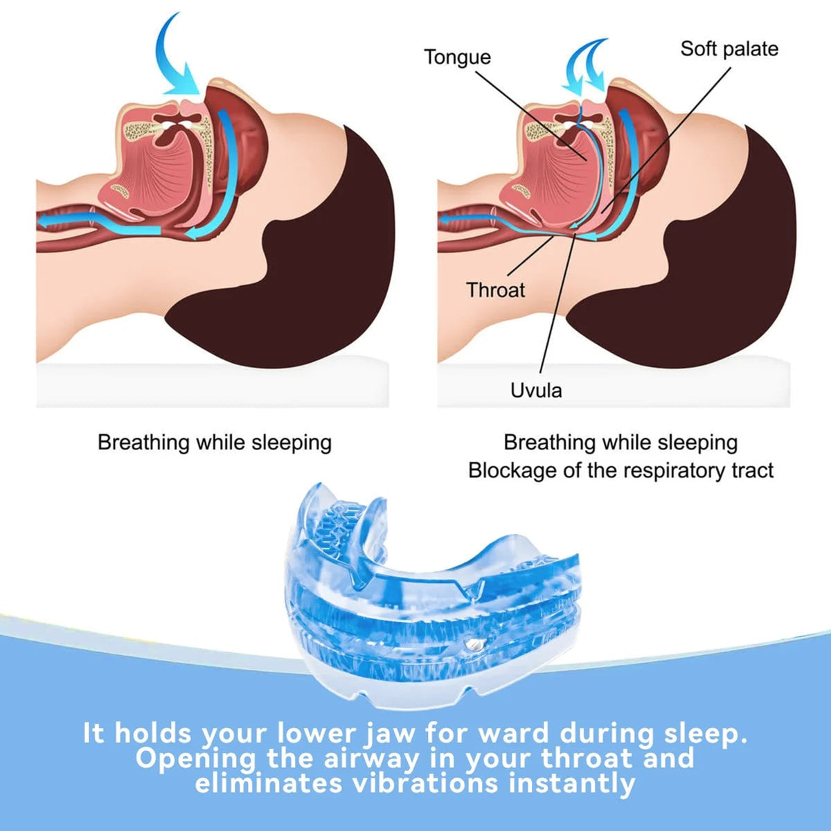 Adjustable Anti Snore Mouthpiece For Men & Women Bpa-Free Snoring Mouth Guard - Image 3